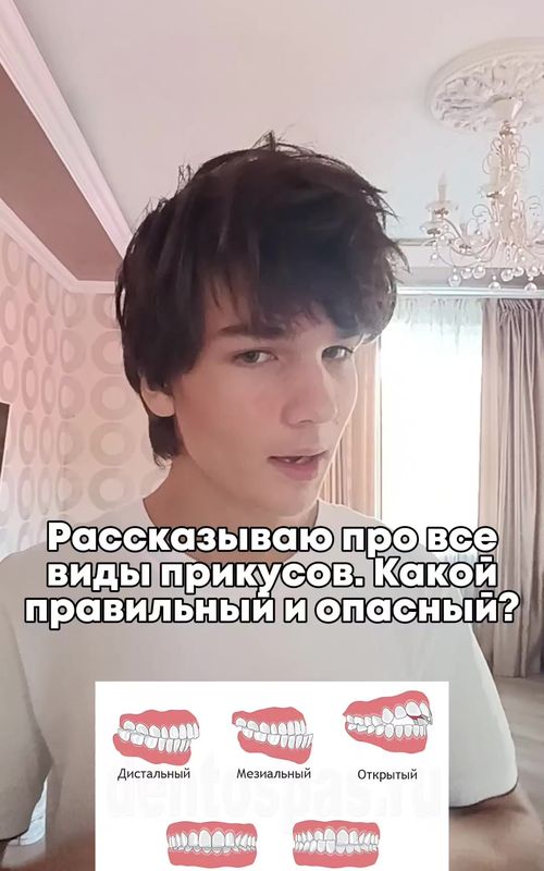 Типы прикуса человека: почему важно следить за здоровьем зубов